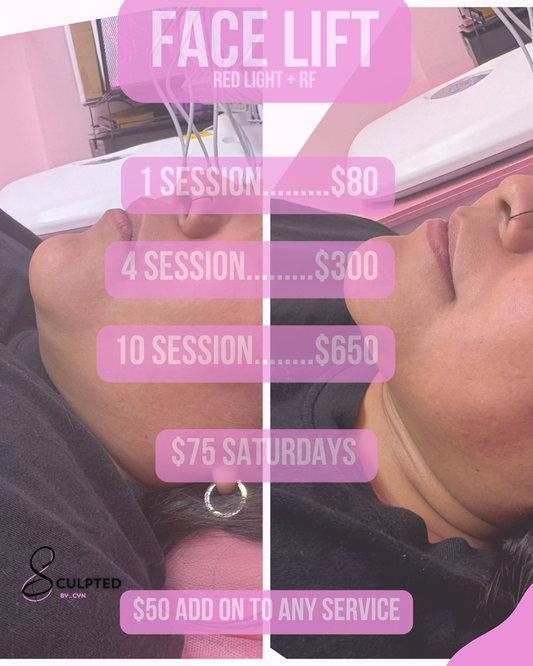 RF Facials